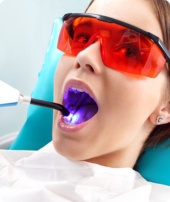 Cosmetic Tooth Bonding | Millennium Dental | General & Family Dentist | SE Calgary
