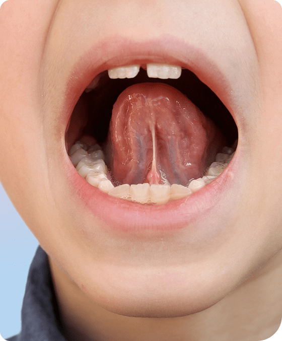 Myofunctional Therapy | Millennium Dental | General & Family Dentist | SE Calgary