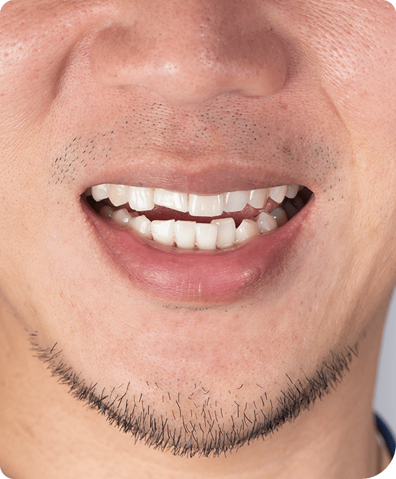 Orthodontics | Millennium Dental | General & Family Dentist | SE Calgary